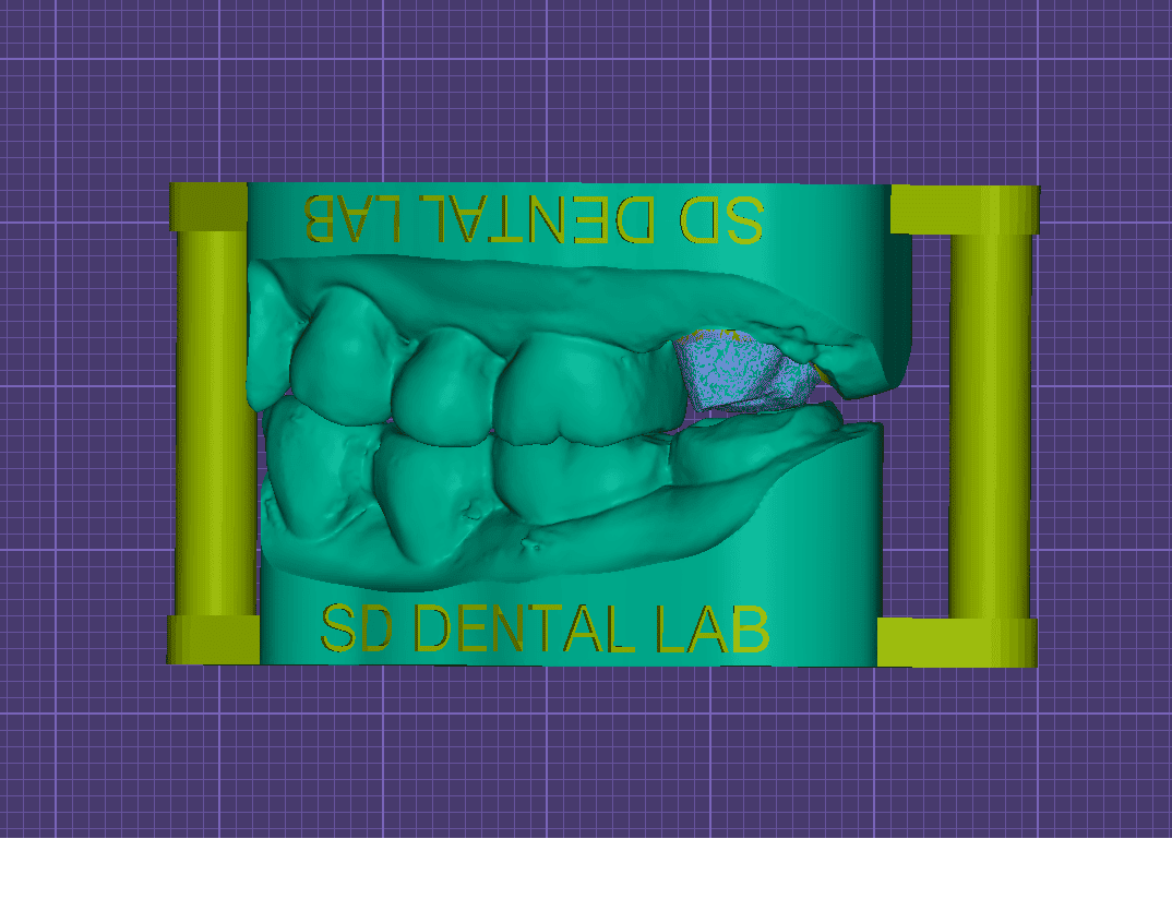 Simple Model
